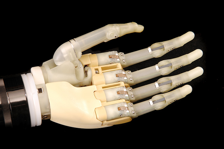 Бионические руки уже могут шевелиться, но пока не могут чувствовать